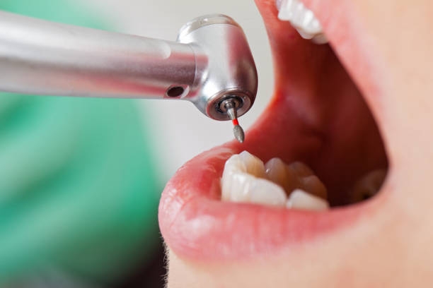 Best Walk-In Emergency Dental Services in Fox River Grove, IL